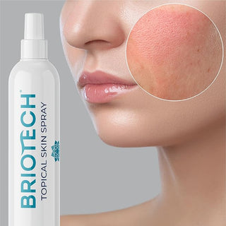 Briotech B00YZDHMWW Topical Skin Spray Hypochlorous Acid Mist for Body