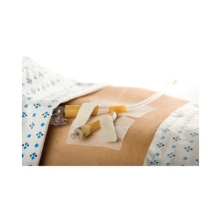 IV line and Cath-Secure Dual Tab® 785700_CS Catheter Holder 3 Inch Wrap Tabs x 3 Inch Wide Base on a patient's arm with a hospital bed in the background
