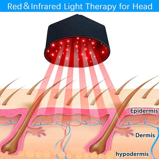 Ireliev M3GH3-01-WG Red Light Therapy Hair Growth Cap
