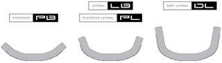 four types of medical device components labeled 'Posterior', 'Lateral', and 'Deep Lateral'.