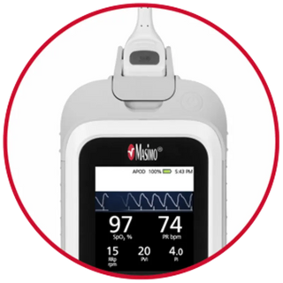 Masimo Rad-G Medical Equipment high-visibility display screen feature