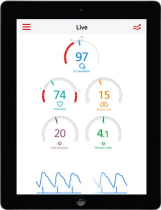 Masimo MightySat Rx display screen showing patient readings
