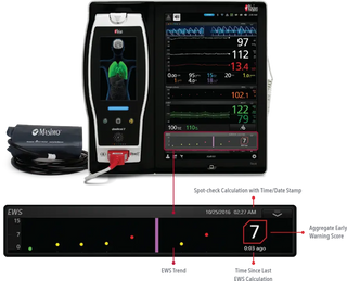 Masimo Root Noninvasive Blood Pressure monitor with feature callouts highlighting key components