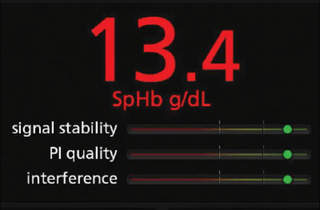 Masimo Rad-67 Medical Equipment innovative technology specifications