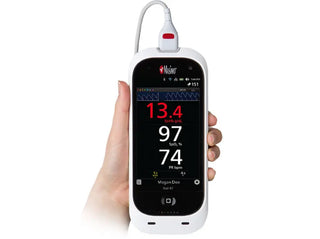 Masimo Rad-67 Medical Equipment spot-check measurement in clinical use