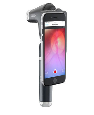 WELCH ALLYN Panoptic Plus Ophthalmoscope-3
